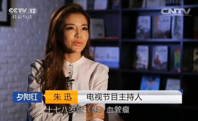 第11张图片